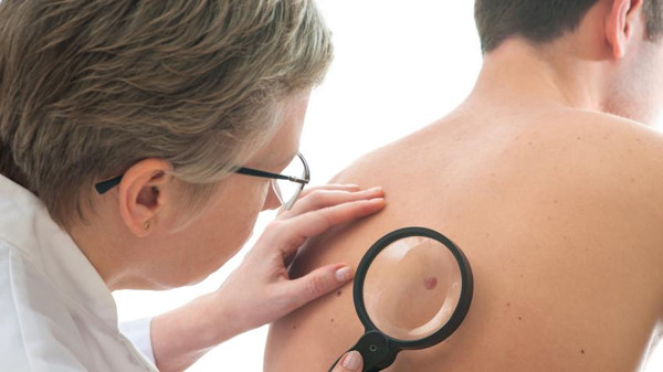 ما هي اعراض سرطان الجلد وطرق الوقاية منه ؟