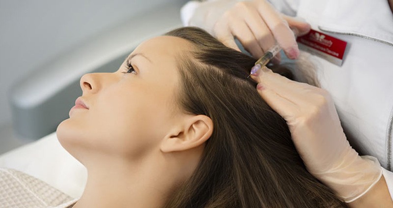 فوائد حقن الميزوثيرابي في علاج الشعر