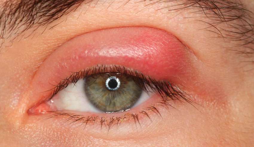 طرق الوقاية من التهاب العين