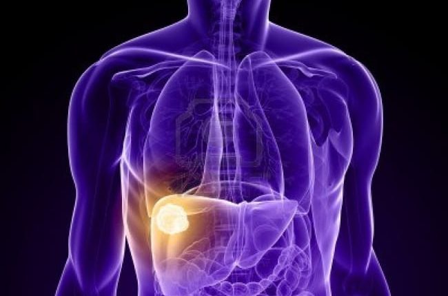 مرض السرطان