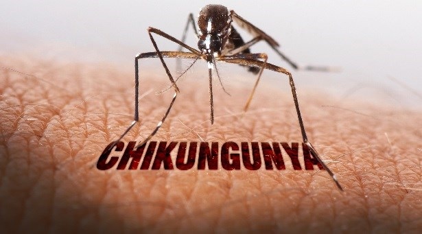 chikungunya الشيكونغونيا
