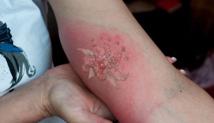 Tattoo