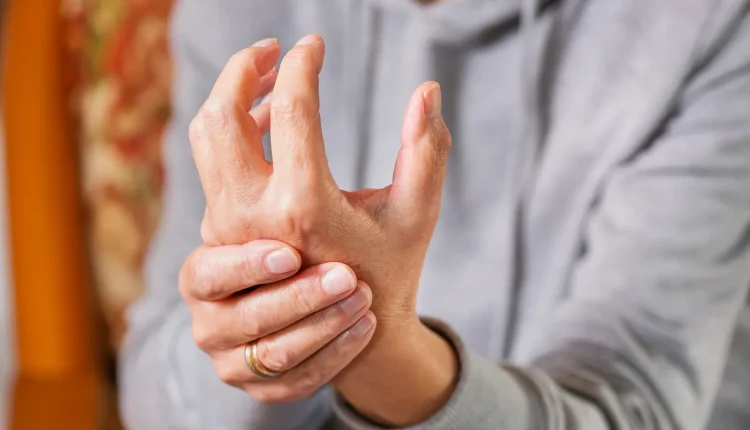 التهاب المفاصل الروماتويدي