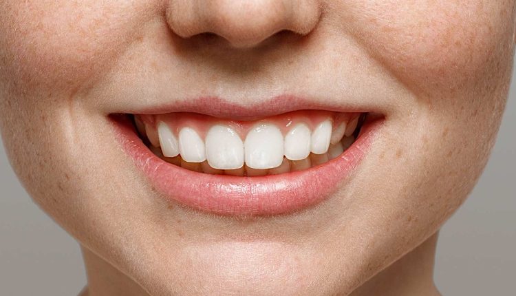 مينا الأسنان