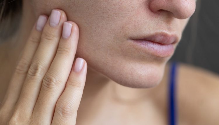 dry skin